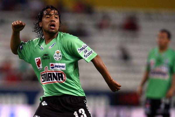 TOP 10: Los más feos de Santos 