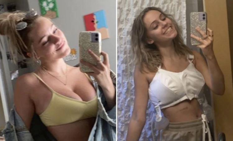 Mujer reduce el tamaño de sus senos para evitar acoso callejero