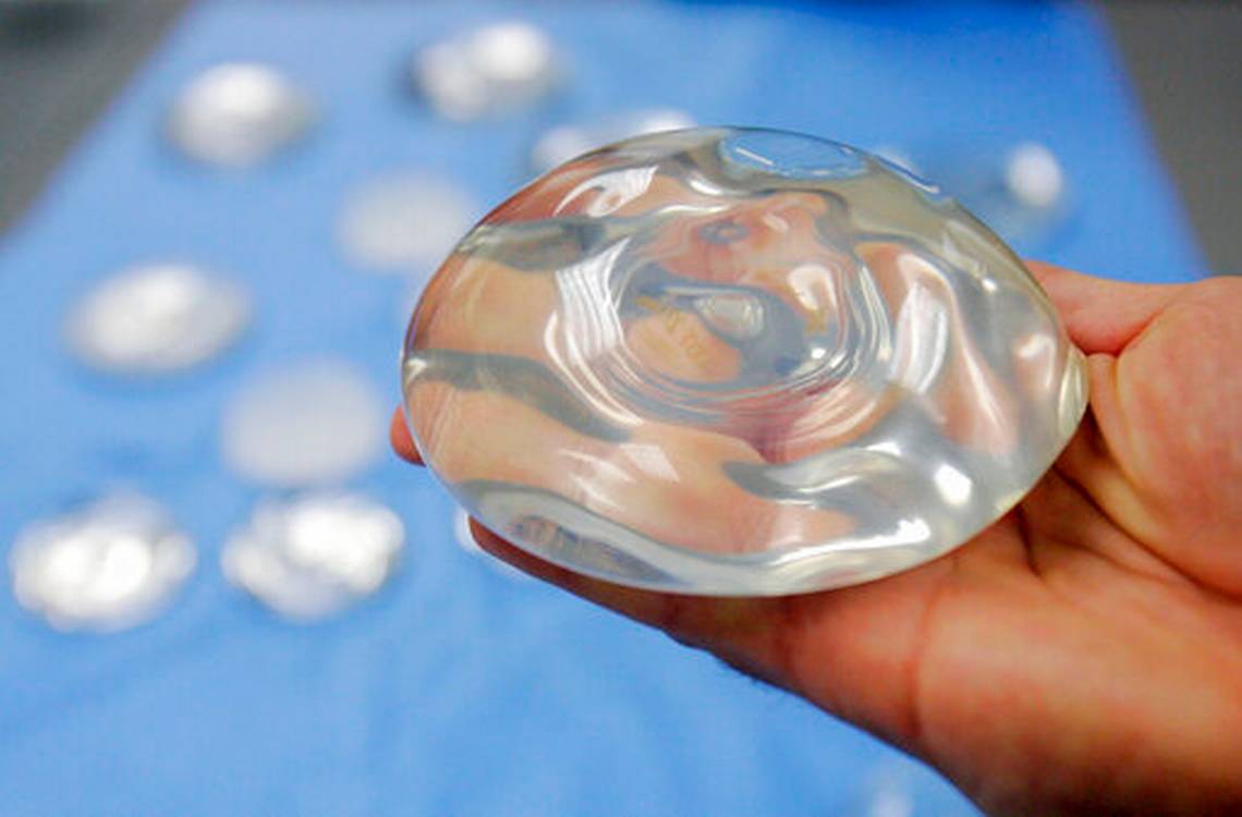 Expertos recomiendan no prohibir implantes mamarios ligados a rara forma de cáncer