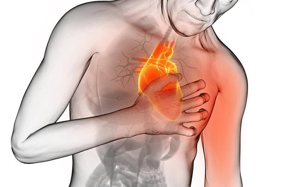 Estos son los síntomas de un infarto y así es cómo se debe reaccionar ante uno