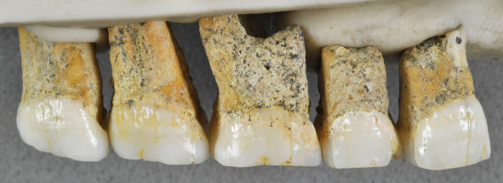 Nueva especie humana es descubierta en Filipinas: 'Homo luzonensis' 