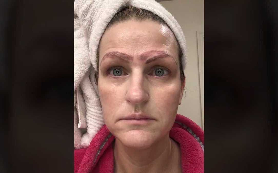 Mujer termina con cuatro cejas por accidente: pagó tratamiento de belleza barato