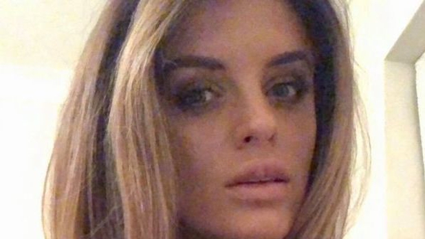 Mujer se deforma labios tras asistir a fiesta de bótox