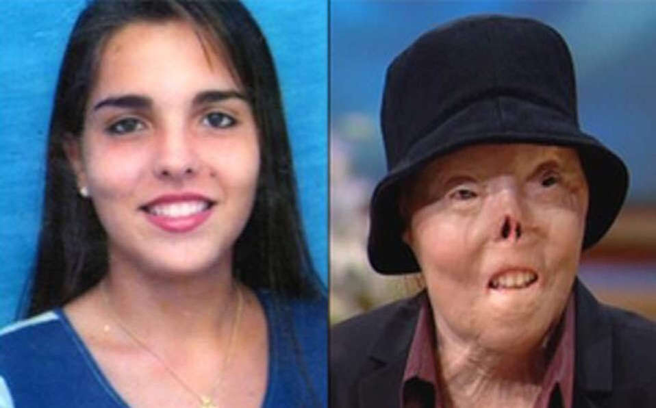 Murió Jacqui Saburido, el rostro de la lucha contra conductores en estado de ebriedad