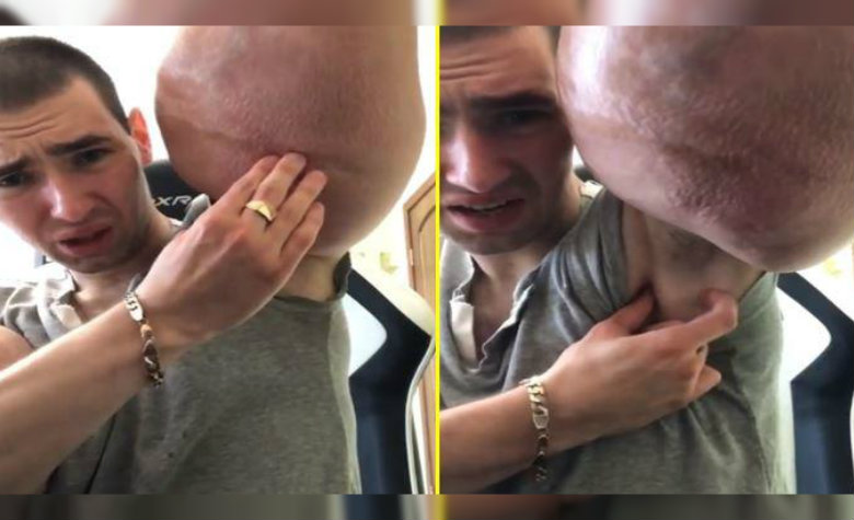 Tras inyectarse aceite en los brazos, fisicoculturista pide ayuda a sus seguidores [VIDEO]