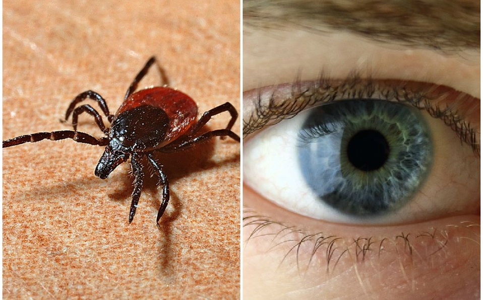 Hombre va al doctor por molestia en el ojo; era una garrapata