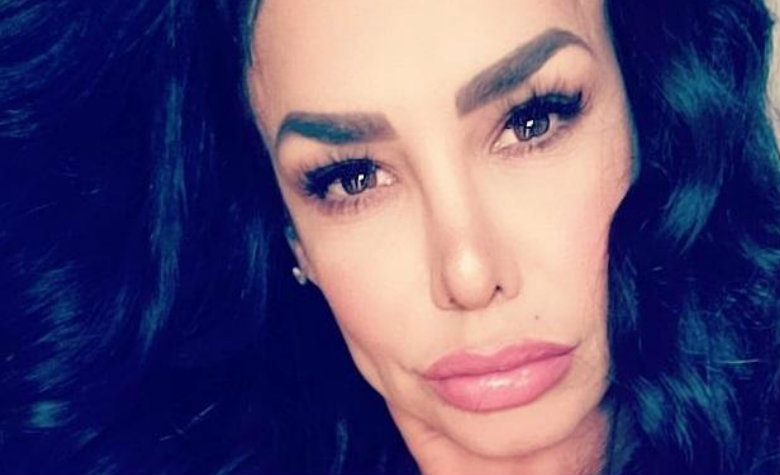 Critican a Lis Vega por el aspecto de su rostro; ella responde