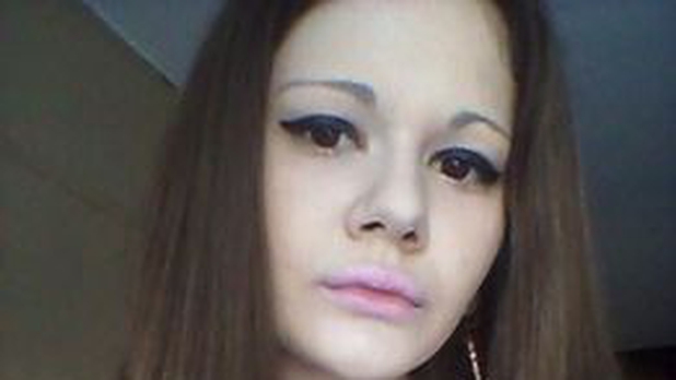 Mujer se somete a 15 cirugías para agrandar sus labios y así luce [FOTOS]