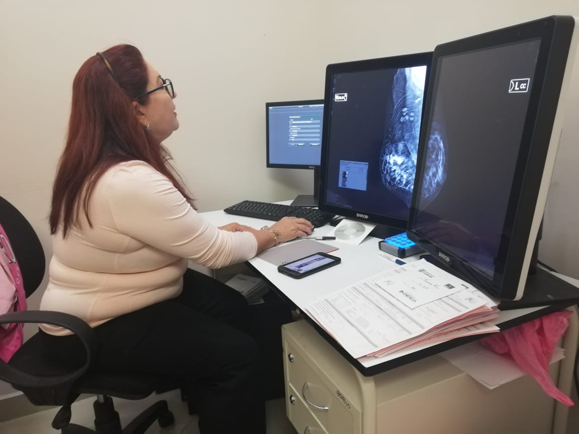 Hospital General de Torreón, único nosocomio con mastógrafo digital