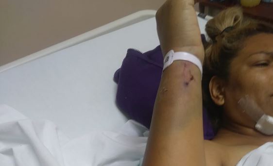 Pareja termina gravemente lesionada tras choque contra camioneta de Fiscalía en Torreón