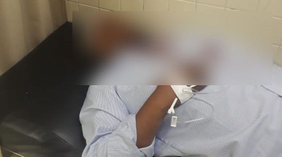 Por intentar salvar a una niña de un pleito, hombre termina con fractura de cráneo en La Laguna