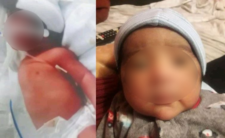 Bebecito lagunero permanece internado por una fuerte bacteria; piden ayuda