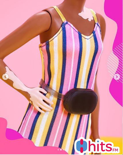 Barbie lanzan muñecas con vitiligio y prótesis