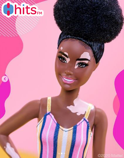 Barbie lanzan muñecas con vitiligio y prótesis