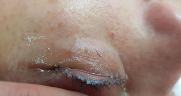 Mujer pide que le apliquen pestañas y le dejan los ojos pegados