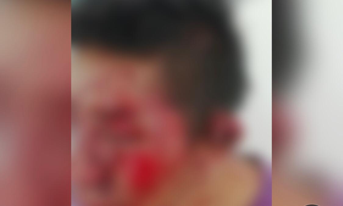¡Le dan tremenda golpiza a presunto ladrón de la Ruta Azteca!