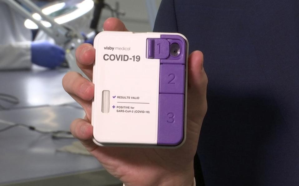 Aprueba FDA prueba portátil para detectar el Covid-19