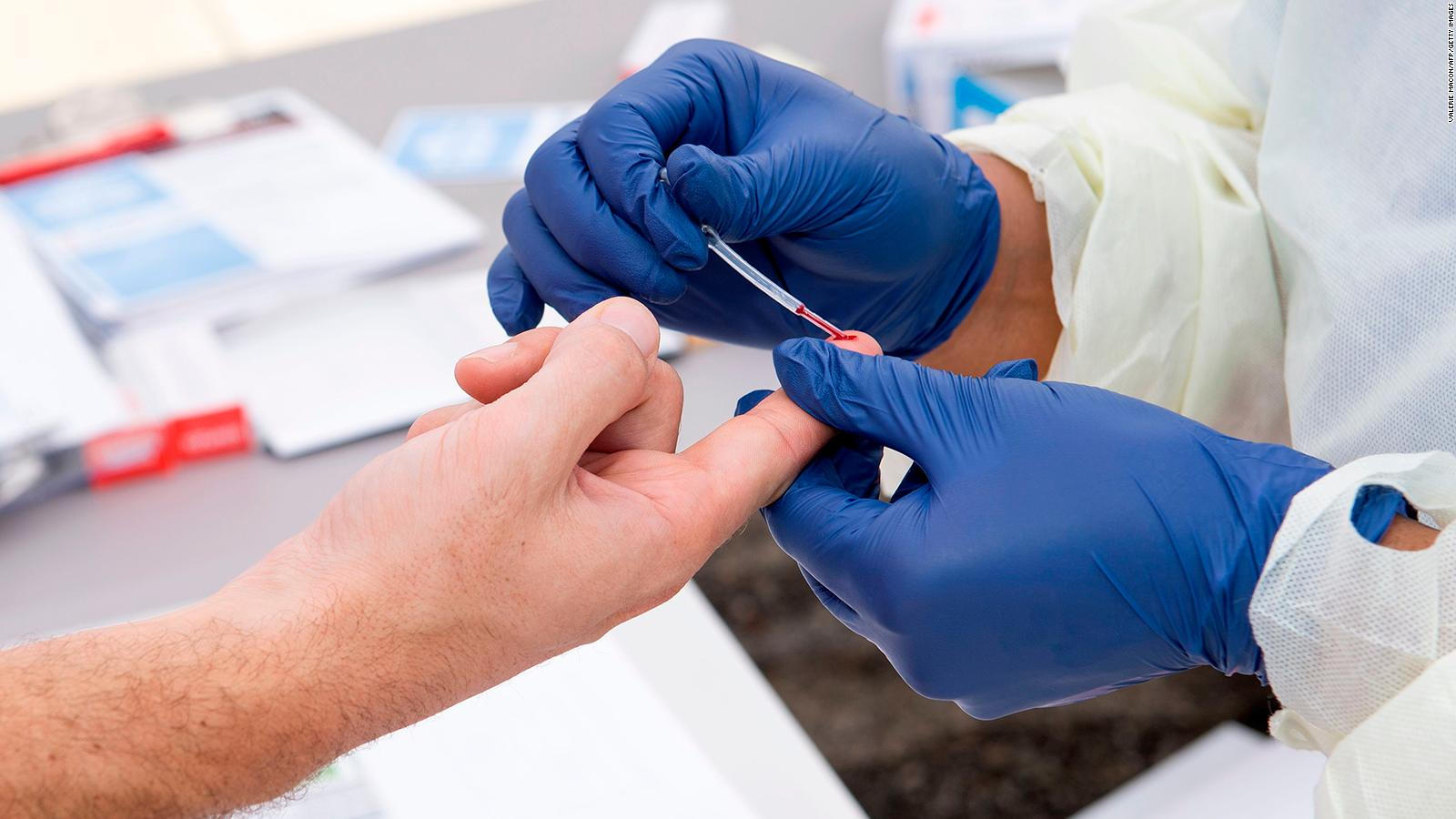 Confirmado, anticuerpos contra el Covid-19 sobreviven más de tres meses en pacientes