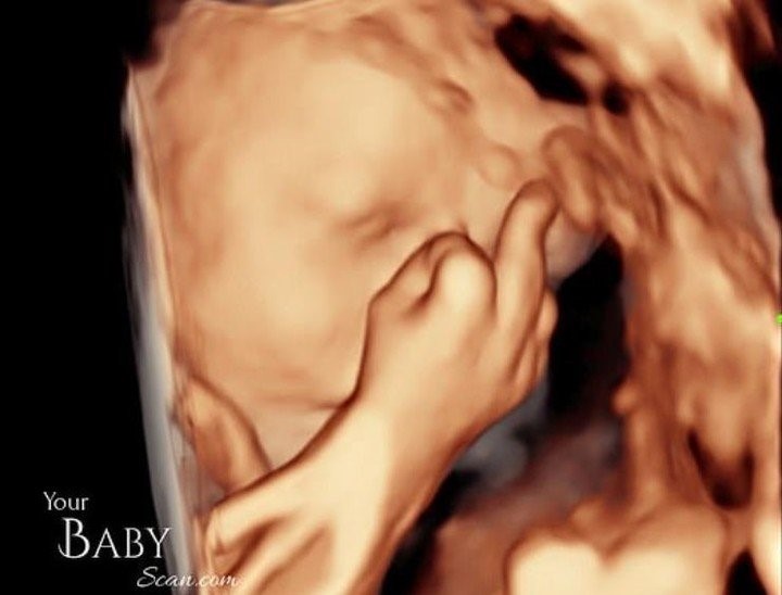 Ecografía muestra a bebé hacer seña obscena y se viraliza