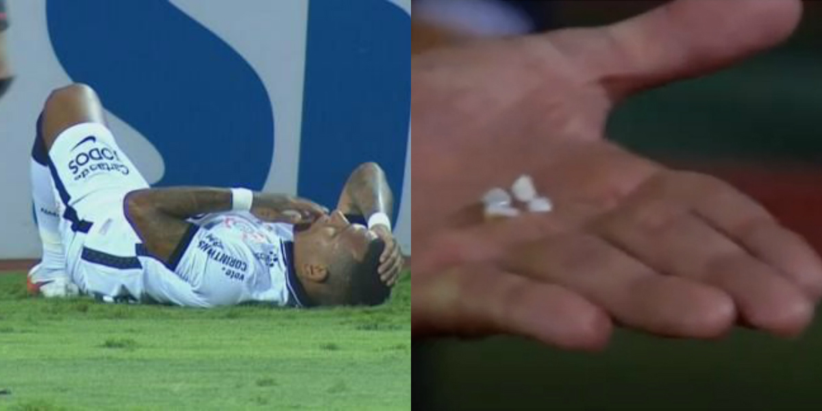 VIDEO: Futbolista pierde cuatro dientes en un choque; su compañero los entrega al árbitro
