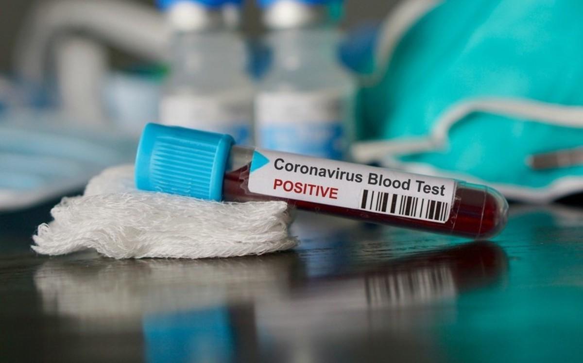 Estalla aparato explosivo dentro de edificio de pruebas de coronavirus; aseguran fue intencional