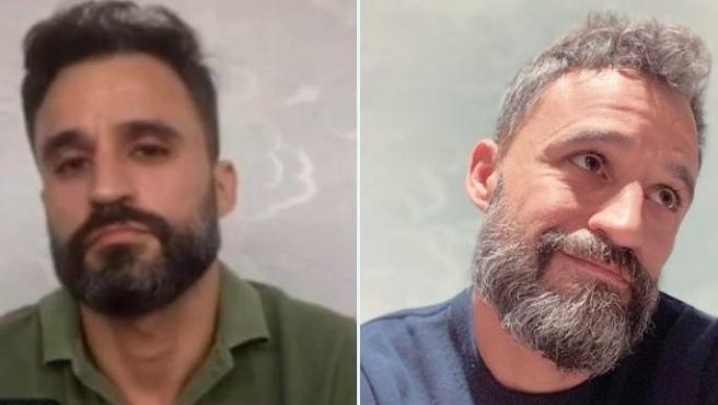 Un enfermero muestra radical cambio físico tras un año de pandemia