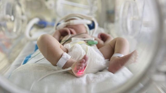 Médicos de Irak registran el primer caso de bebé con tres penes