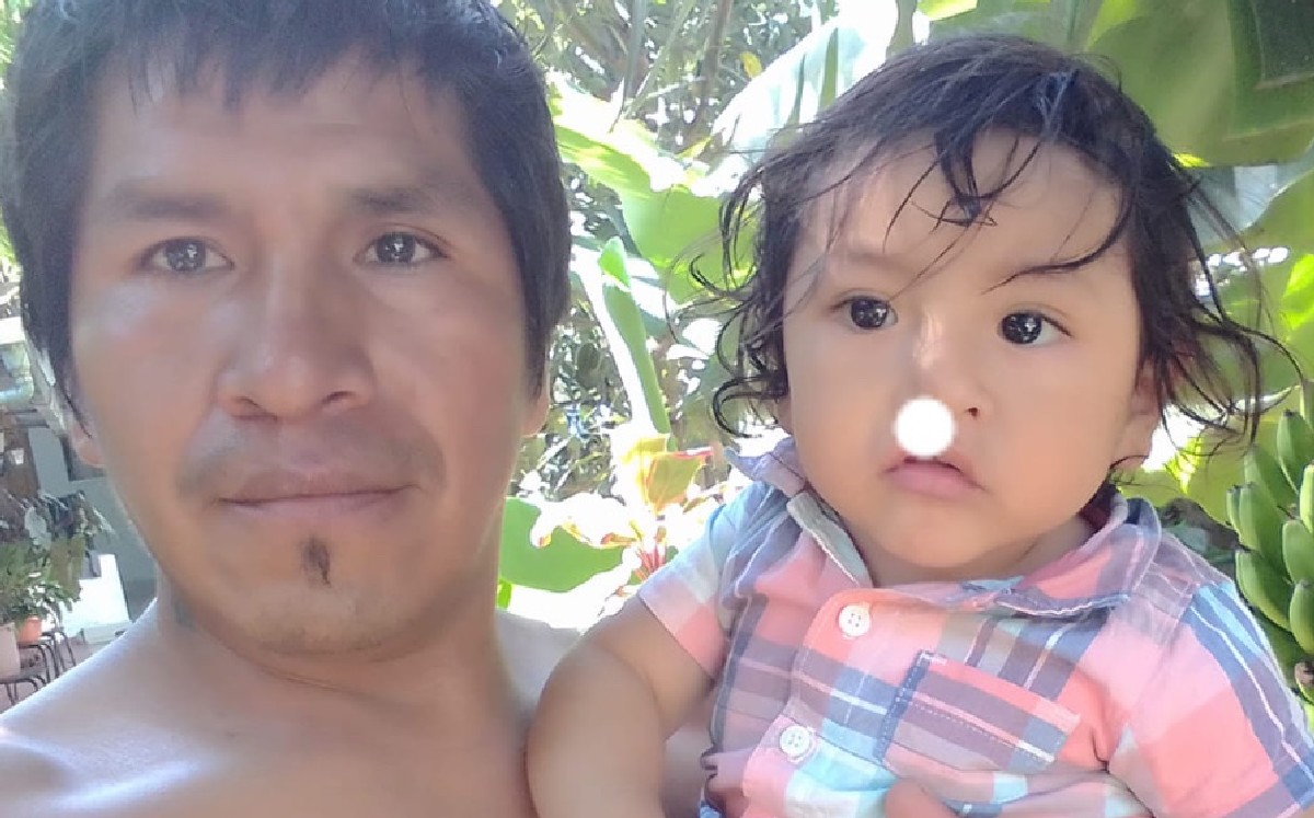 Madre abandona a su hijo por tener labio leporino; padre lo saca adelante