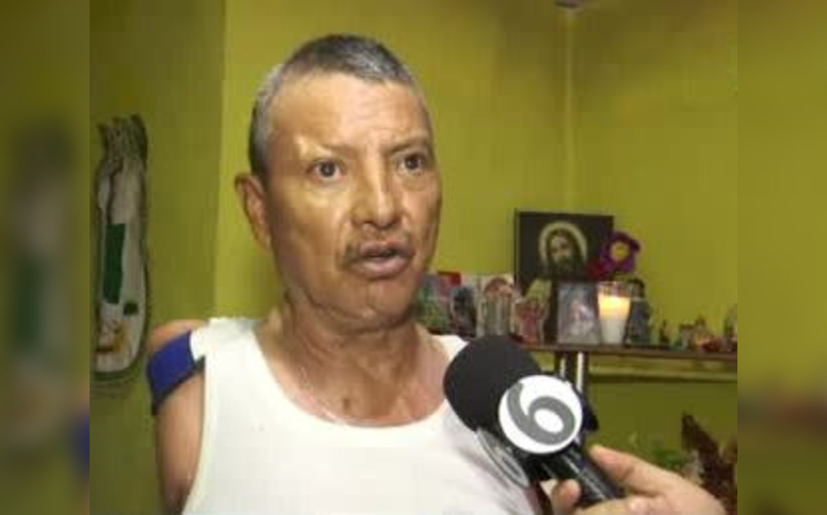 Hombre pide apoyo tras amputación de brazos por accidente laboral 
