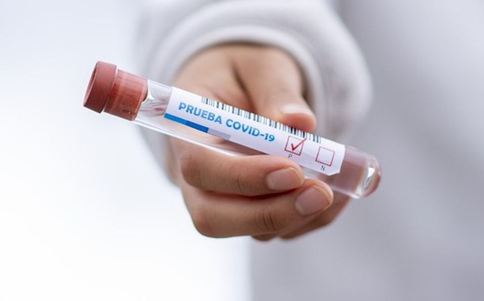 Jalisco suma 135 contagios y 10 muertes por coronavirus