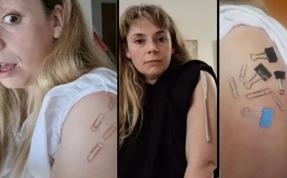 Mujer asegura que brazo vacunado contra Covid-19 quedó como imán