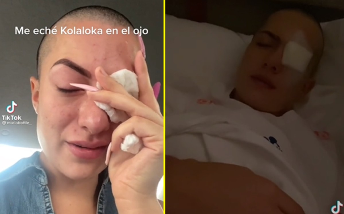 Tiktoker confunde Kola Loka con sus gotas y se las echa en el ojo (VIDEO)