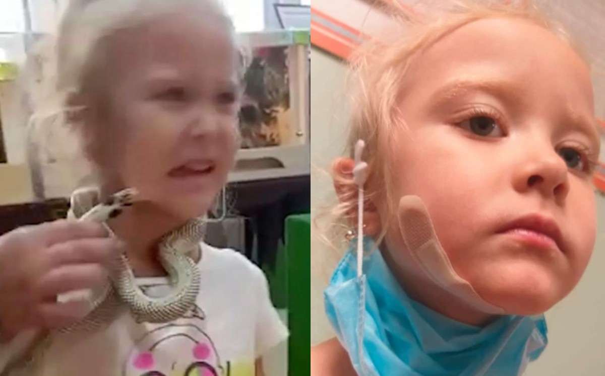Serpiente muerde a niña de 5 años en zoológico