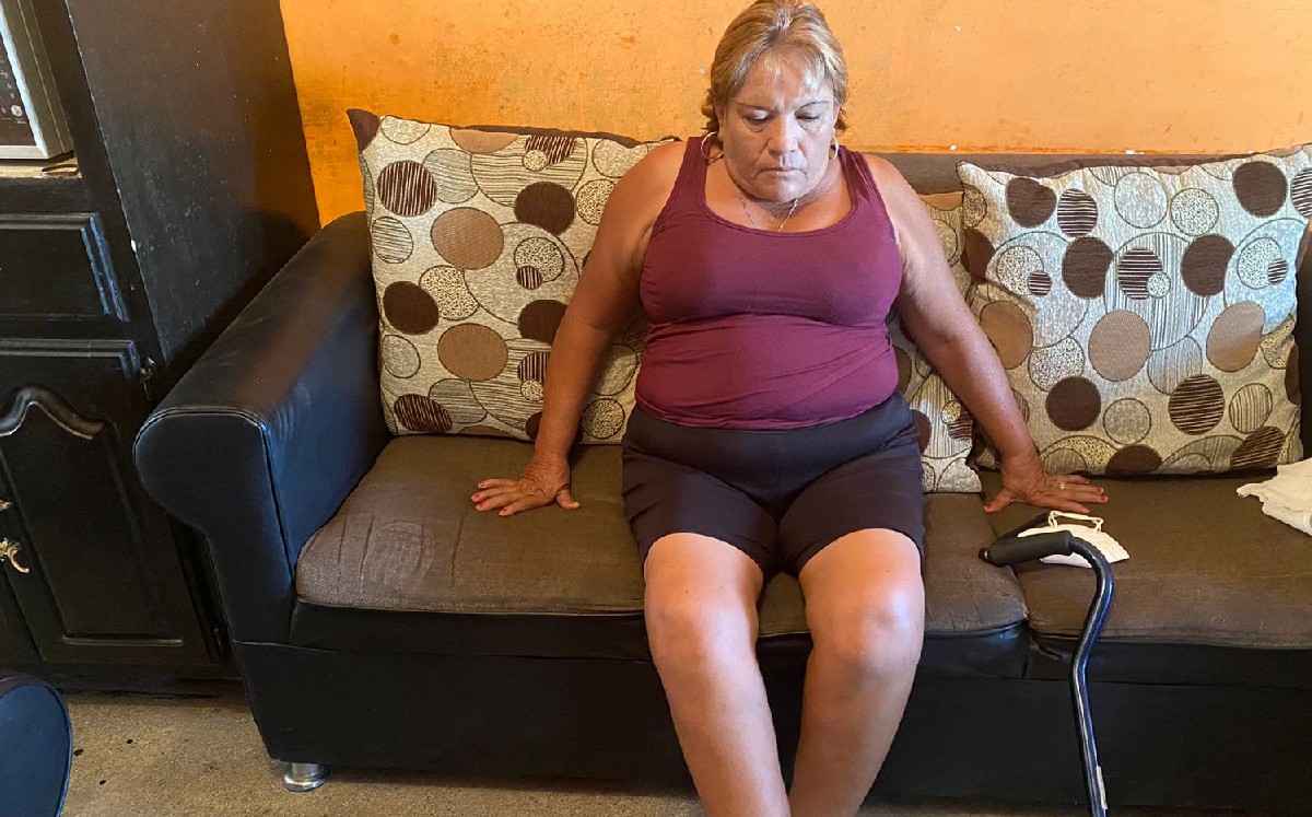 Lagunera a punto de perder su pierna tras ser atacada por su perro pide ayuda