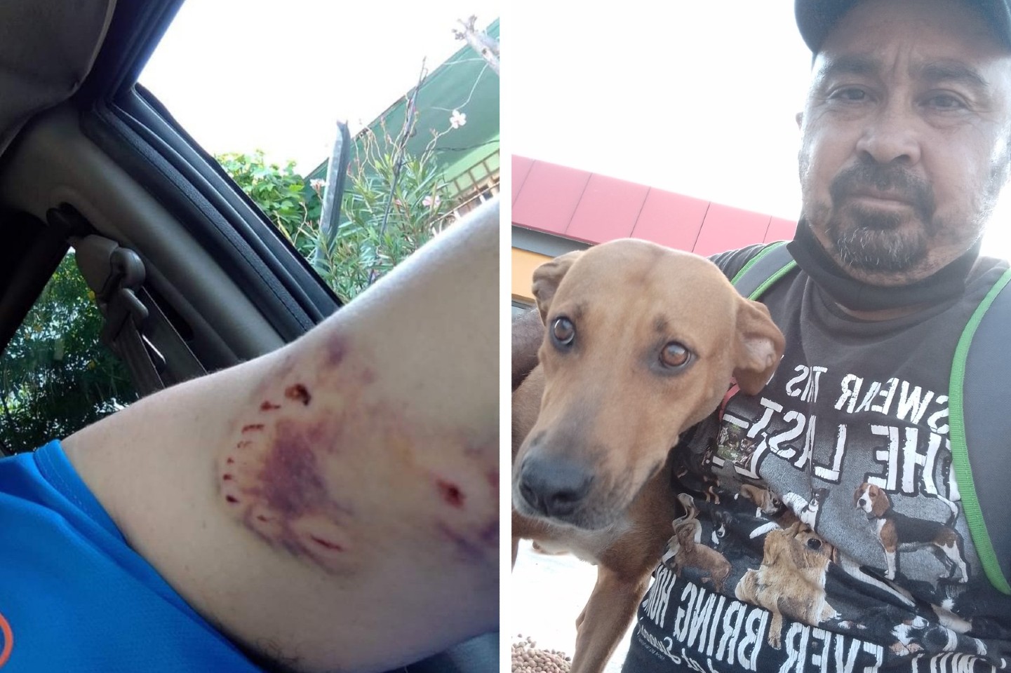 Hombre rescata a perrita de la calle que lo atacó; historia viral