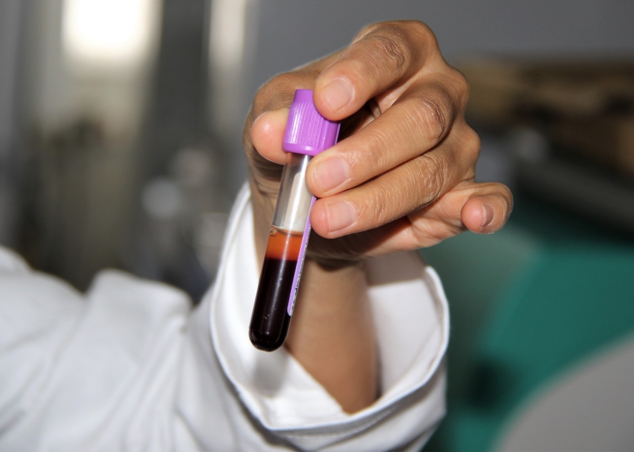 Estudiantes del ‘Poli’ buscan reducir niveles de colesterol en la sangre con electroacupuntura