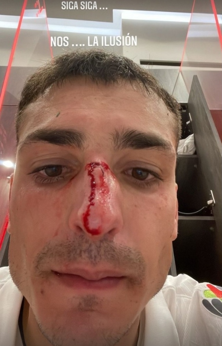 Juan Ignacio Dinenno, delantero de Pumas / Instagram @juandinenno