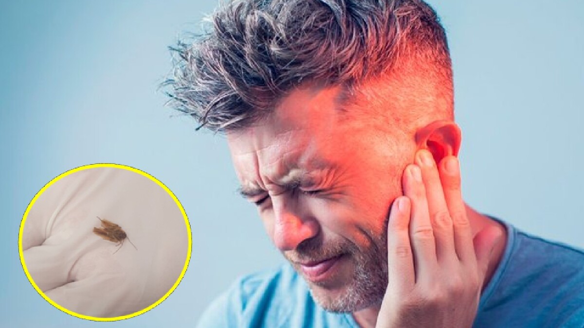 El hombre acudió al doctor por un intenso dolor de cabeza. El hombre acudió al doctor por un intenso dolor de cabeza.