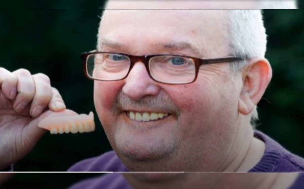 El hombre recibió su dentadura postiza a domicilio en Inglaterra / Especial