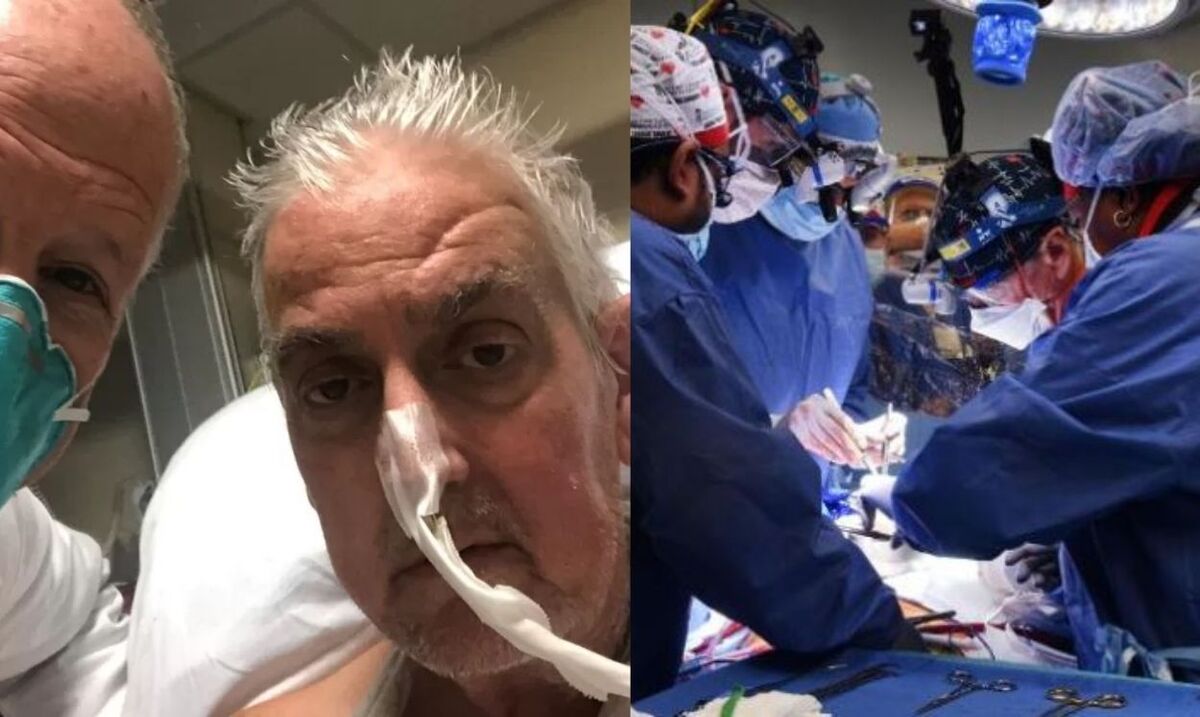 Muere hombre que recibió trasplante de corazón de cerdo. / Universidad de Maryland.