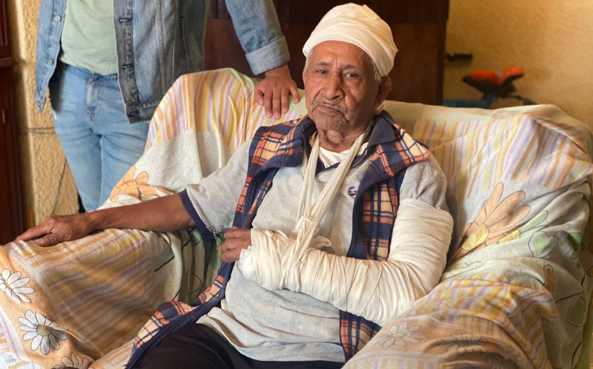 Don Juan recibió nueve puntadas y sufrió la fractura de un brazo /César García
