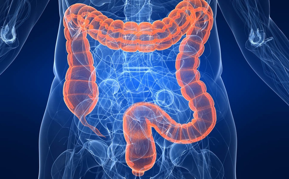 El cáncer de colóncaua 21 muertes diarias en México/ Shutterstock
