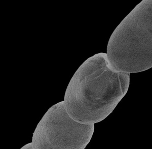 Bacteria más grande del mundo / Especial Bacteria más grande del mundo / Especial
