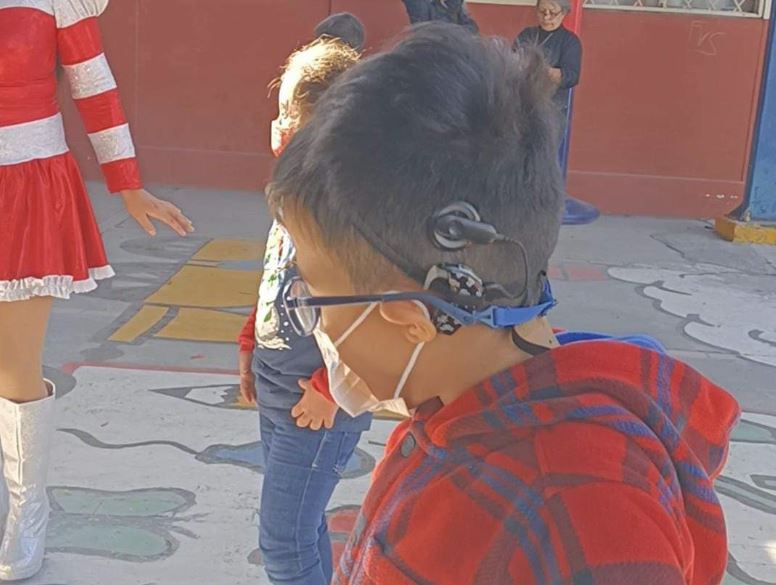 El aparato únicamente es compatible con el implante que tiene el pequeño de 8 años. | Cortesía