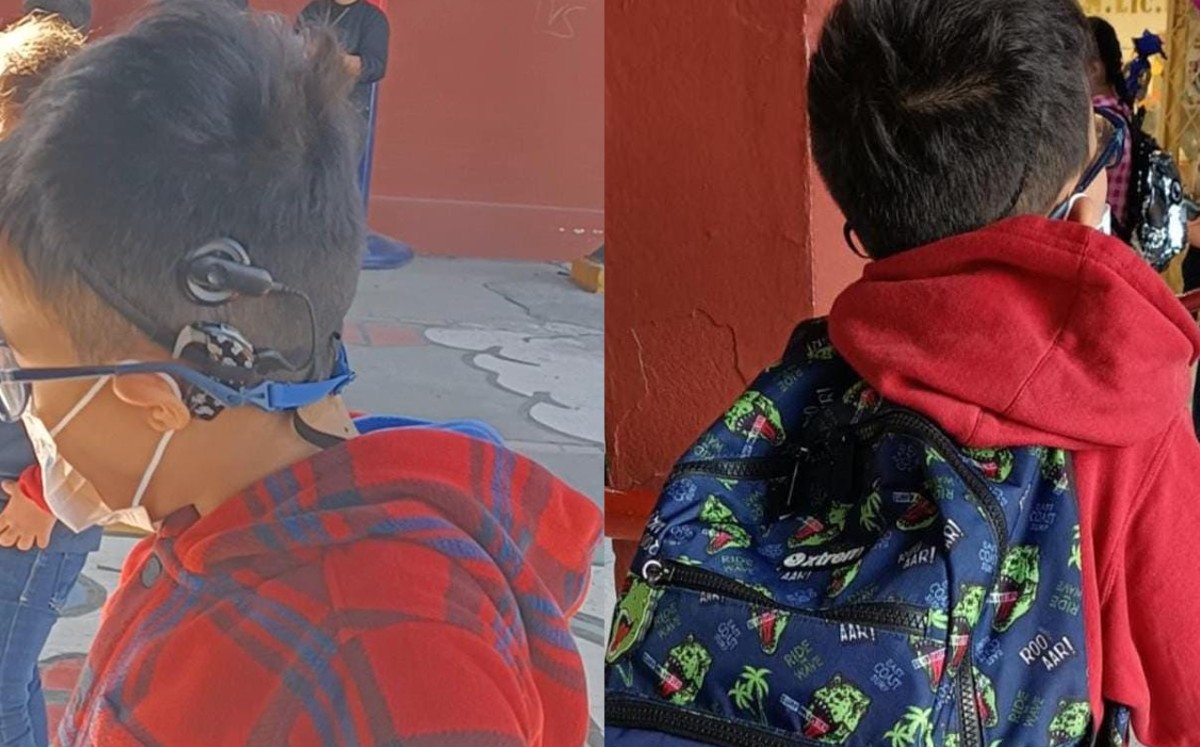 Aparato auditivo de niño de 9 años en Cumbres | Cortesía