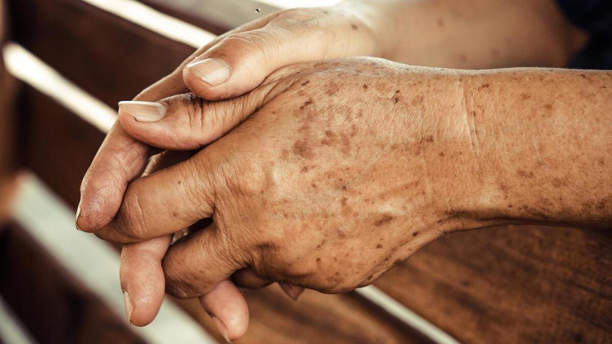 La recomendación del especialista es respaldada por estudios de salud e incluso atletas. | Cortesía