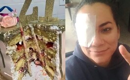 una mujer fue empujada al pastel, lo que no sabían es que tenía palillos en su interior que casi le cuestan un ojo.