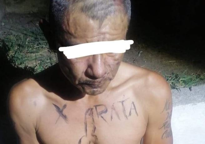 El hombre que lo auxiliaba señaló que observó al herido emplayado en la plaza de la colonia, por lo que lo ayudó. | Israel Santacruz