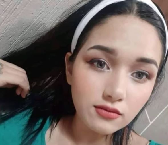 Elvia Liliana Fernández sufrió quemaduras en brazos, pecho y rostro luego de ser abusada física y sexualmente. | Cortesía