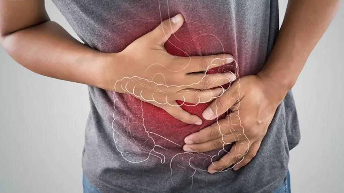 Entre las mejores maneras para evitar la colitis se encuentra una buena alimentación.